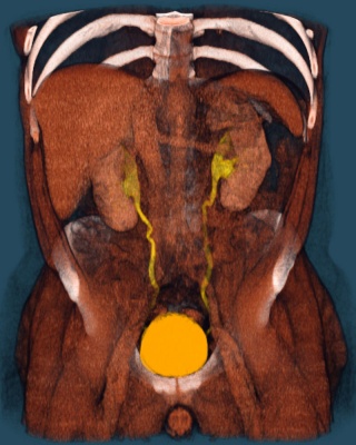 магнитно-резонансная томография брюшной полости с холангиографией