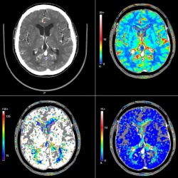снимки томографии головного мозга ребенка