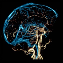 снимок МРТ сосудов головы