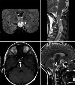 снимок томографии мозга головы и области шеи